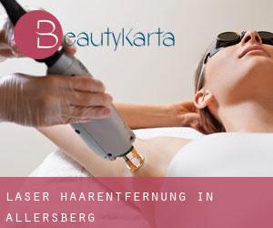 Laser-Haarentfernung in Allersberg