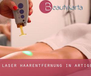 Laser-Haarentfernung in Artige