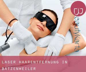 Laser-Haarentfernung in Batzenweiler