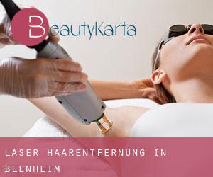 Laser-Haarentfernung in Blenheim