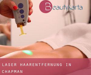 Laser-Haarentfernung in Chapman