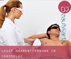 Laser-Haarentfernung in Chasselay