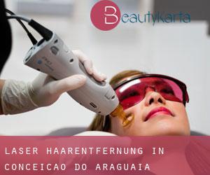 Laser-Haarentfernung in Conceição do Araguaia