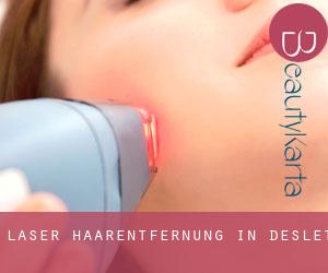 Laser-Haarentfernung in Deslet