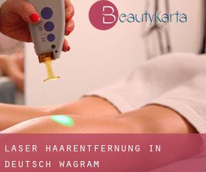 Laser-Haarentfernung in Deutsch-Wagram