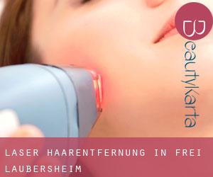Laser-Haarentfernung in Frei-Laubersheim