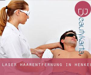 Laser-Haarentfernung in Henkel