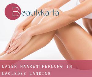 Laser-Haarentfernung in Lacledes Landing