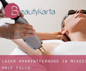 Laser-Haarentfernung in McKees Half Falls