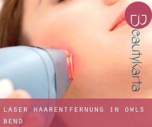 Laser-Haarentfernung in Owls Bend