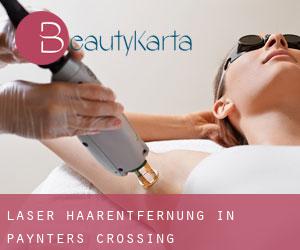 Laser-Haarentfernung in Paynters Crossing