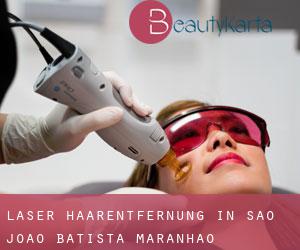 Laser-Haarentfernung in São João Batista (Maranhão)