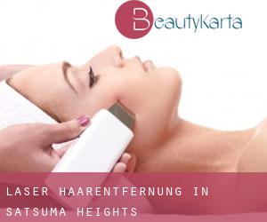 Laser-Haarentfernung in Satsuma Heights