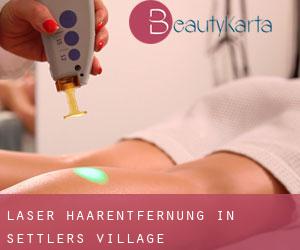 Laser-Haarentfernung in Settlers Village