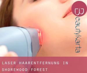 Laser-Haarentfernung in Shorewood Forest