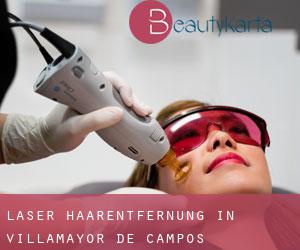 Laser-Haarentfernung in Villamayor de Campos